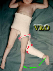 Lorenz_VRO_Sm Lorenz_VRO_Sm