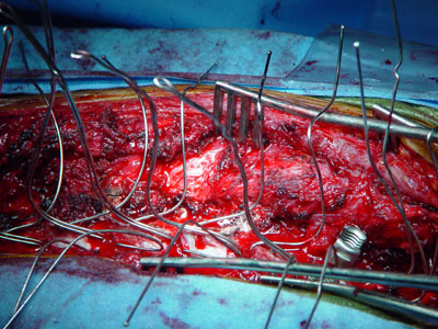 Wires passed and shaped so as